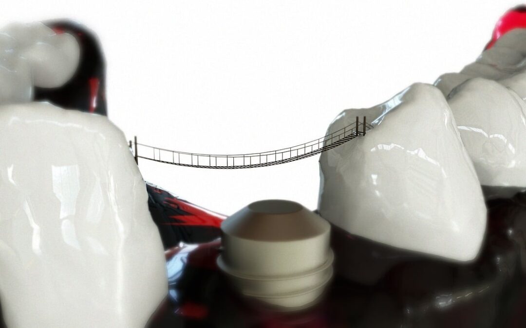 Implantat