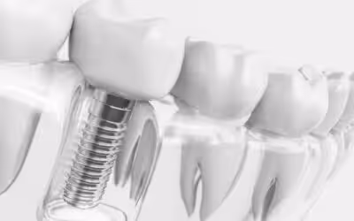 Implantat
