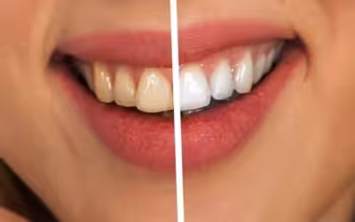 Bleaching