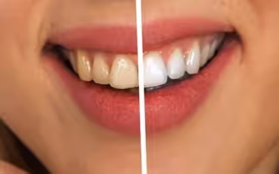 Bleaching