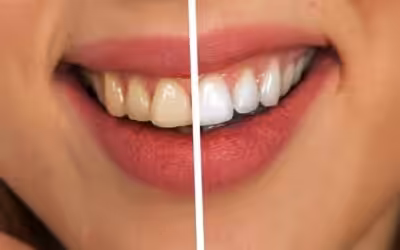 Bleaching