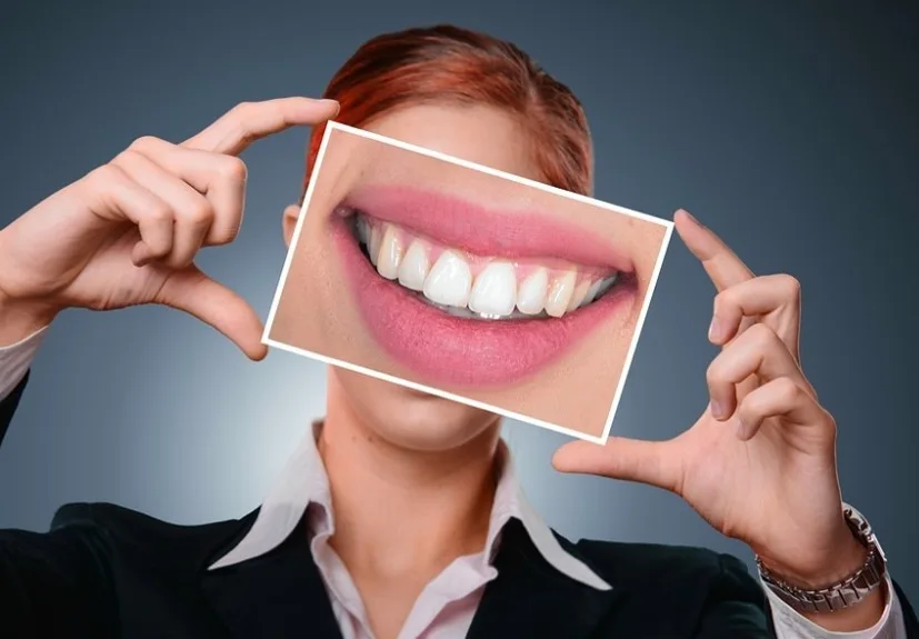 Zahn Bleaching bei Ihrem Zahnarzt in Biel