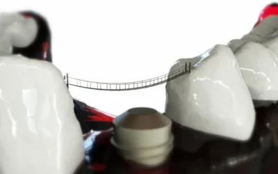 implants dentaires / dentist Bienne